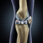 Knee Knee