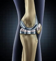 Knee Knee