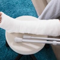 BrokenLegCast BrokenLegCast