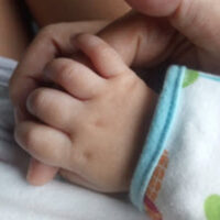 BirthInj_babyHand BirthInj_babyHand